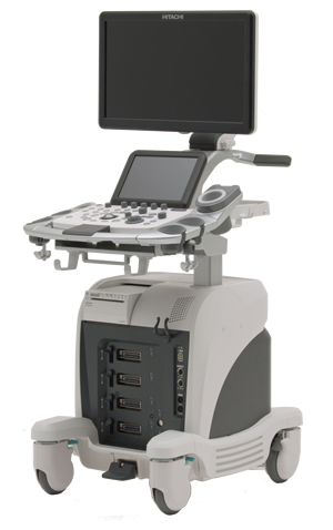 超音波診断装置(エコー)